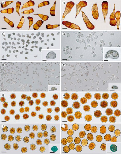 Rust fungus spores